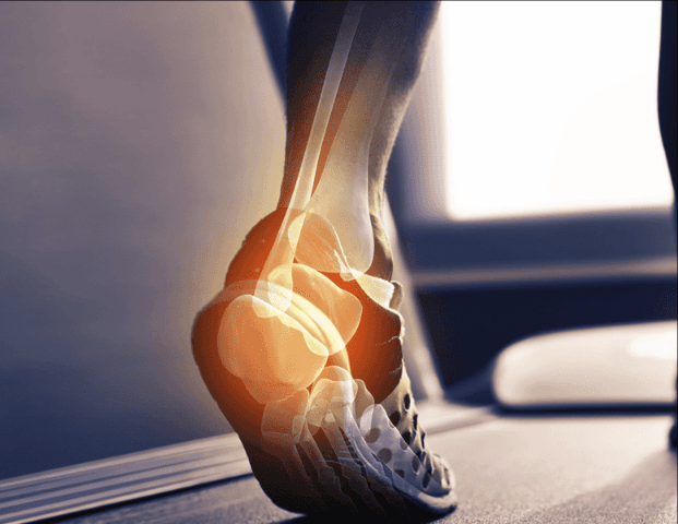 Physiotherapy treatment and rehabilitation equipment